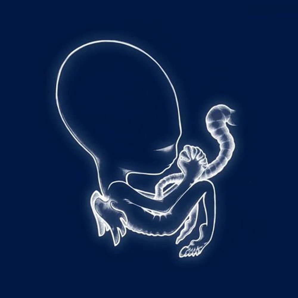 Ágætis byrjun — Sigur Rós